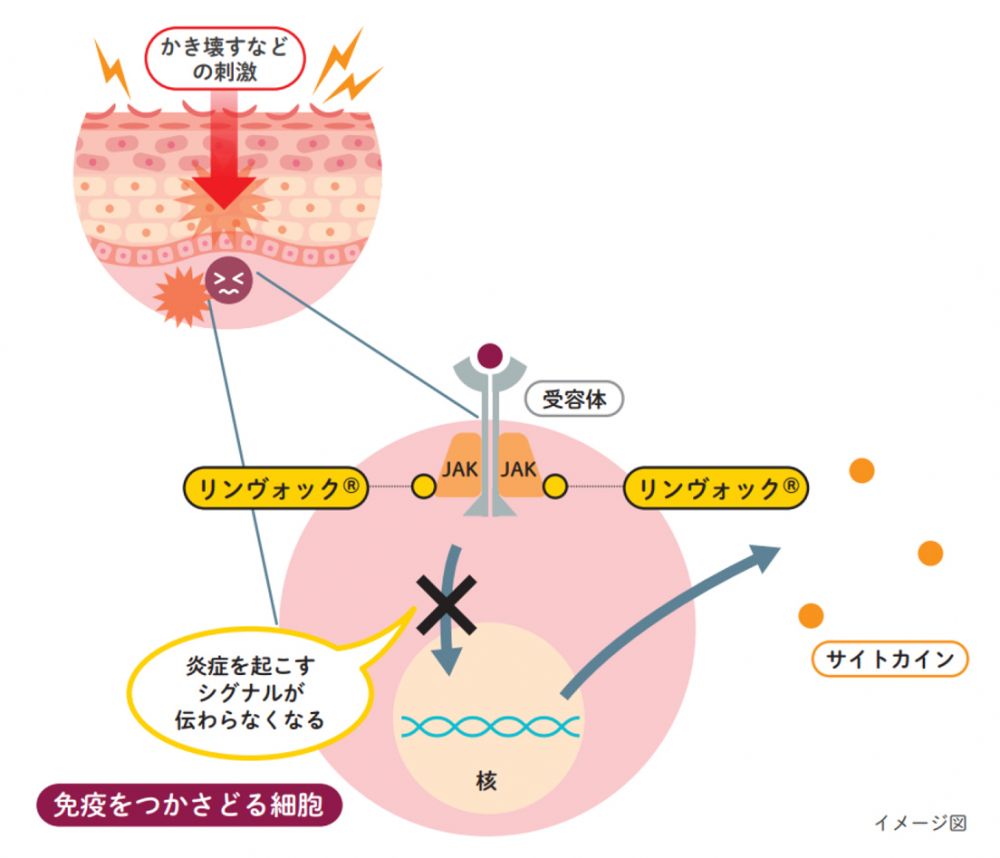 リンヴォック®とは